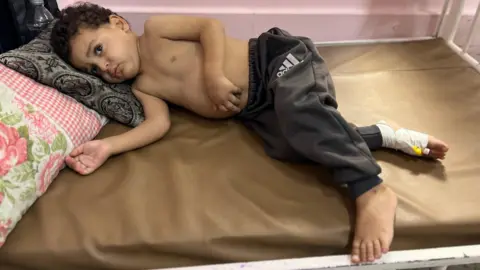 BBC Zain Tafesh, a small Palestinian boy, laying topless on his hospital bed